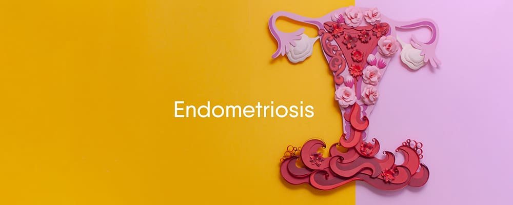 Endometriosis
